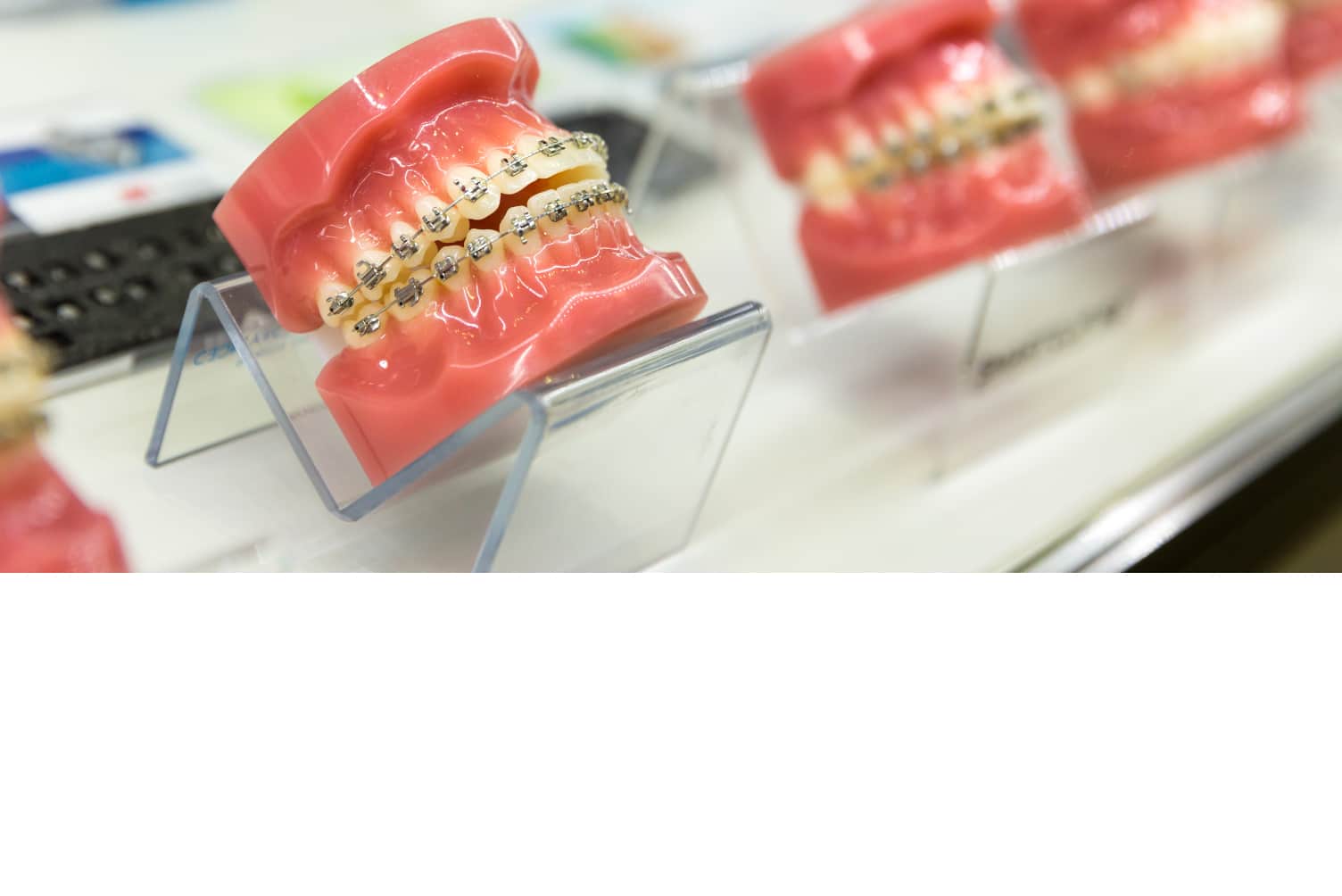 Braces, FastBraces & Clear Aligners Irving TX